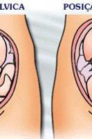 imagem pelvico cefalico